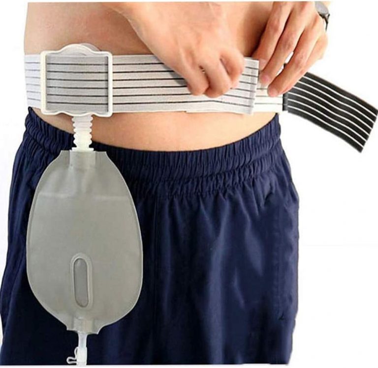 1.12377 Edukasi Irigasi Urostomi SIKI Standart Intervensi